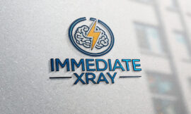 Immediate Xray recensioni 2025 – sicuro o una truffa?